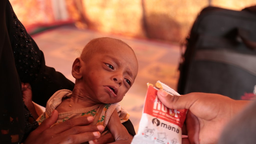 yemen desnutricion