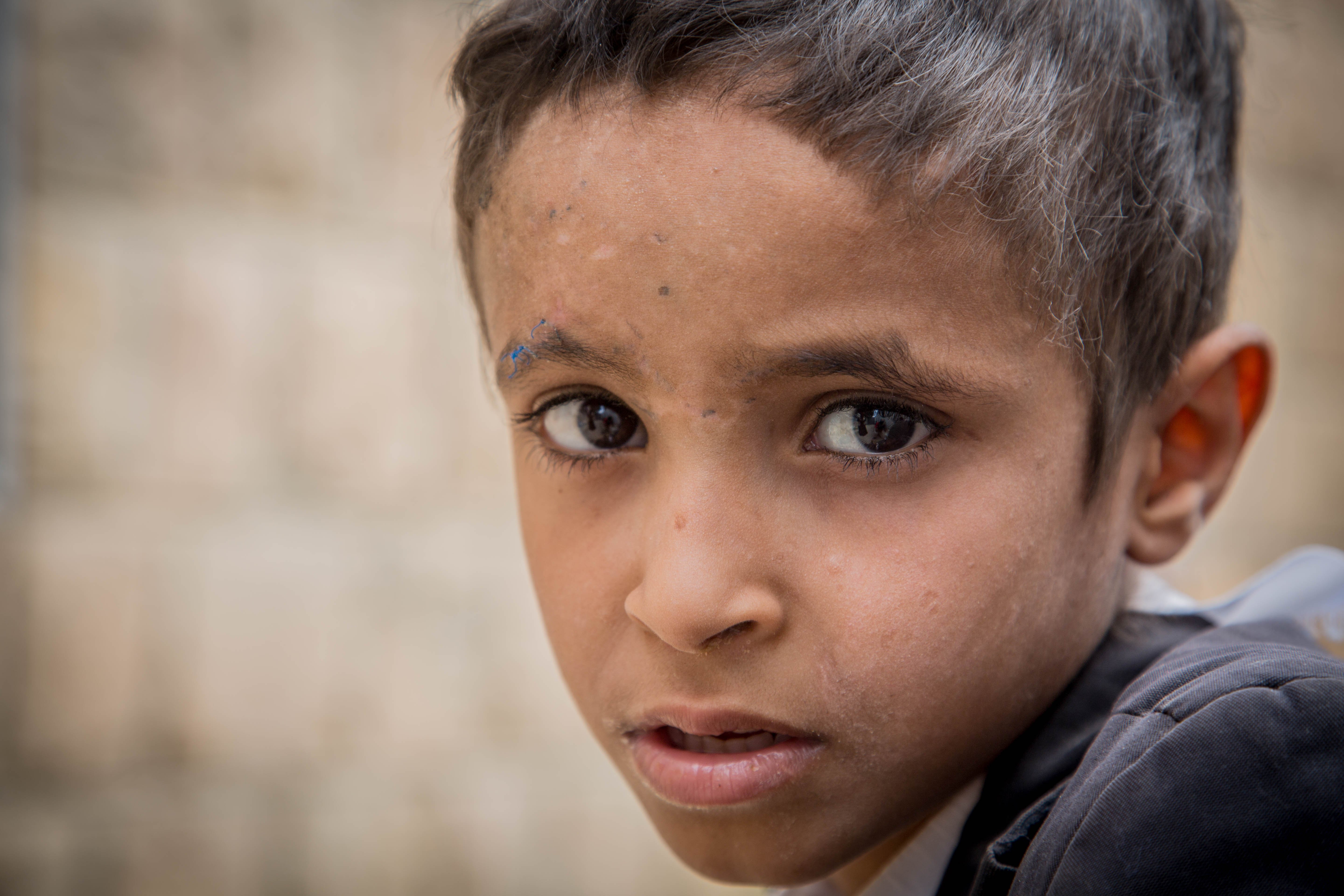 niño que vive en zona de guerra niño que vive en zona de guerra