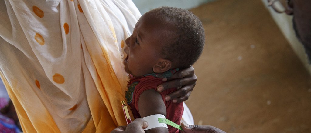 desnutricion-mauritania.jpg desnutricion-mauritania.jpg