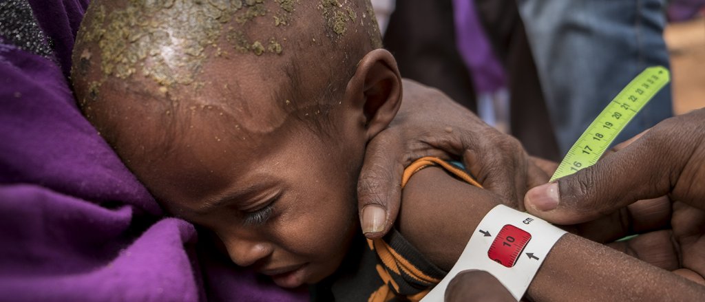 sequia-somalia-desnutricionc.jpg sequia-somalia-desnutricionc.jpg