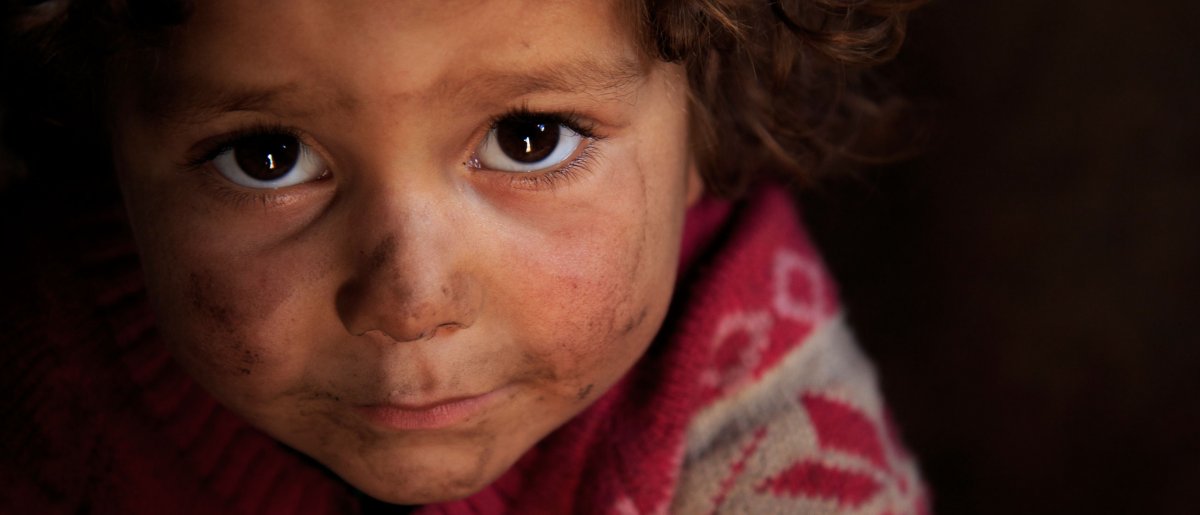 Fátima tiene 3 años y es una víctima de la Guerra Fátima tiene 3 años y es una víctima de la Guerra