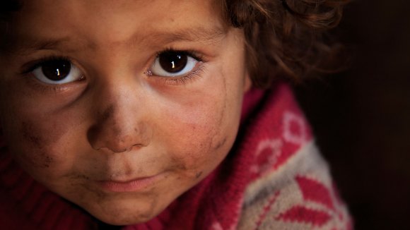 Fátima tiene 3 años y es una víctima de la Guerra Fátima tiene 3 años y es una víctima de la Guerra