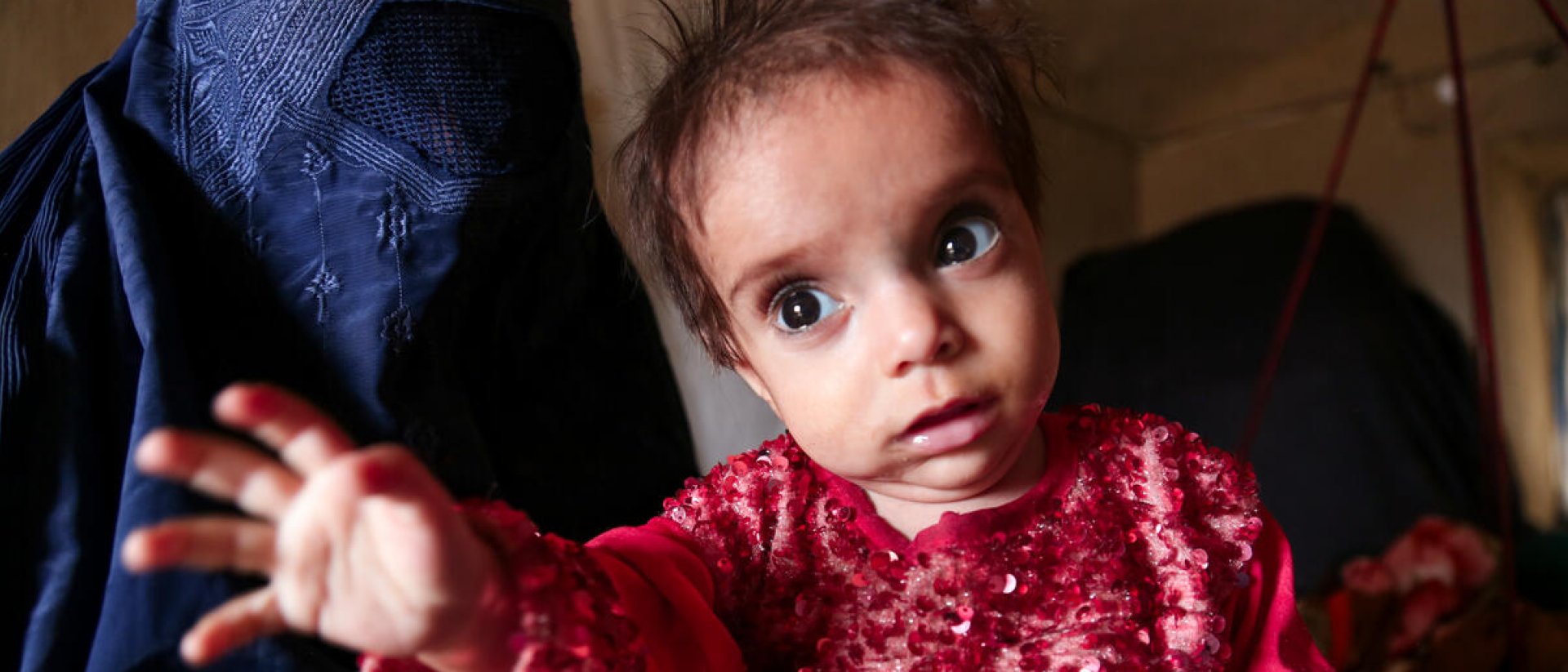 Ara, bebé de Afganistán 