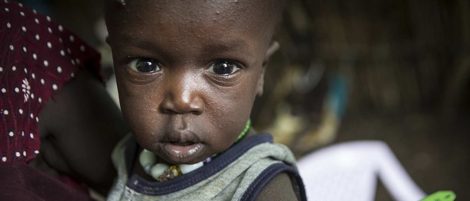 desnutricion-infantil-save-children.jpg desnutricion-infantil-save-children.jpg