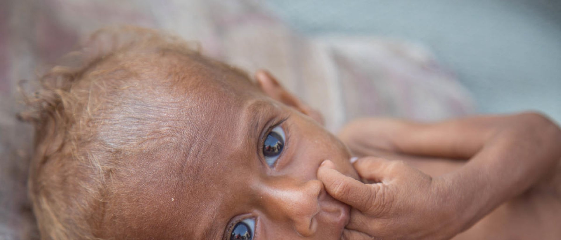 yemen-desnutricion.jpg yemen-desnutricion.jpg