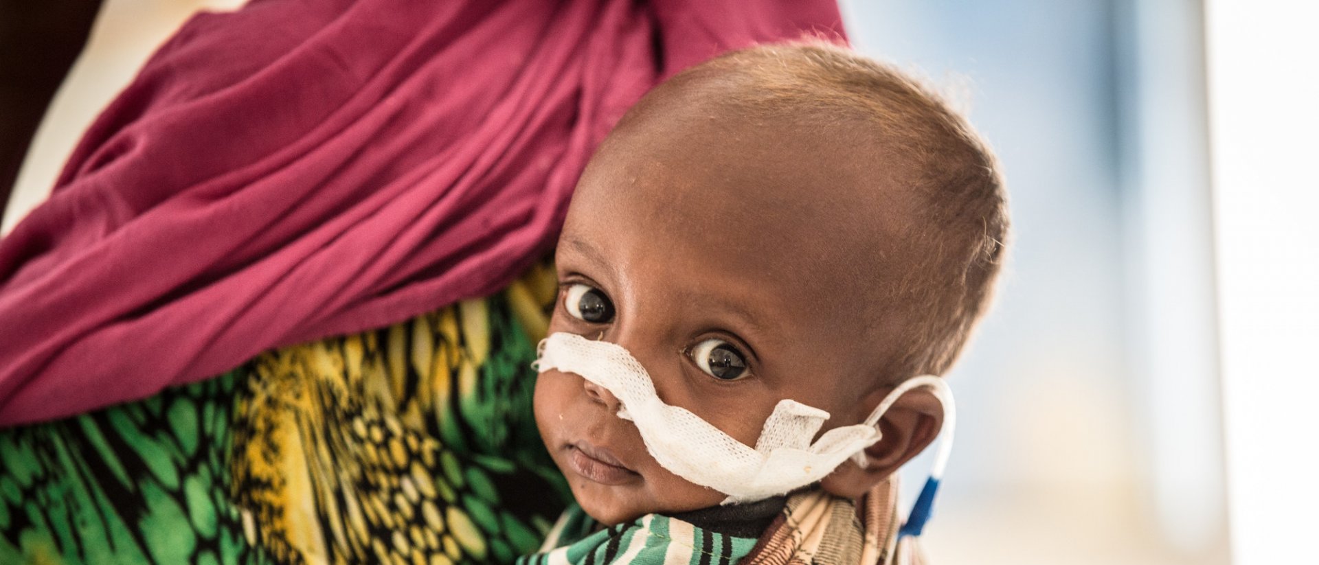 desnutricion-somalia-savethechildren.jpg