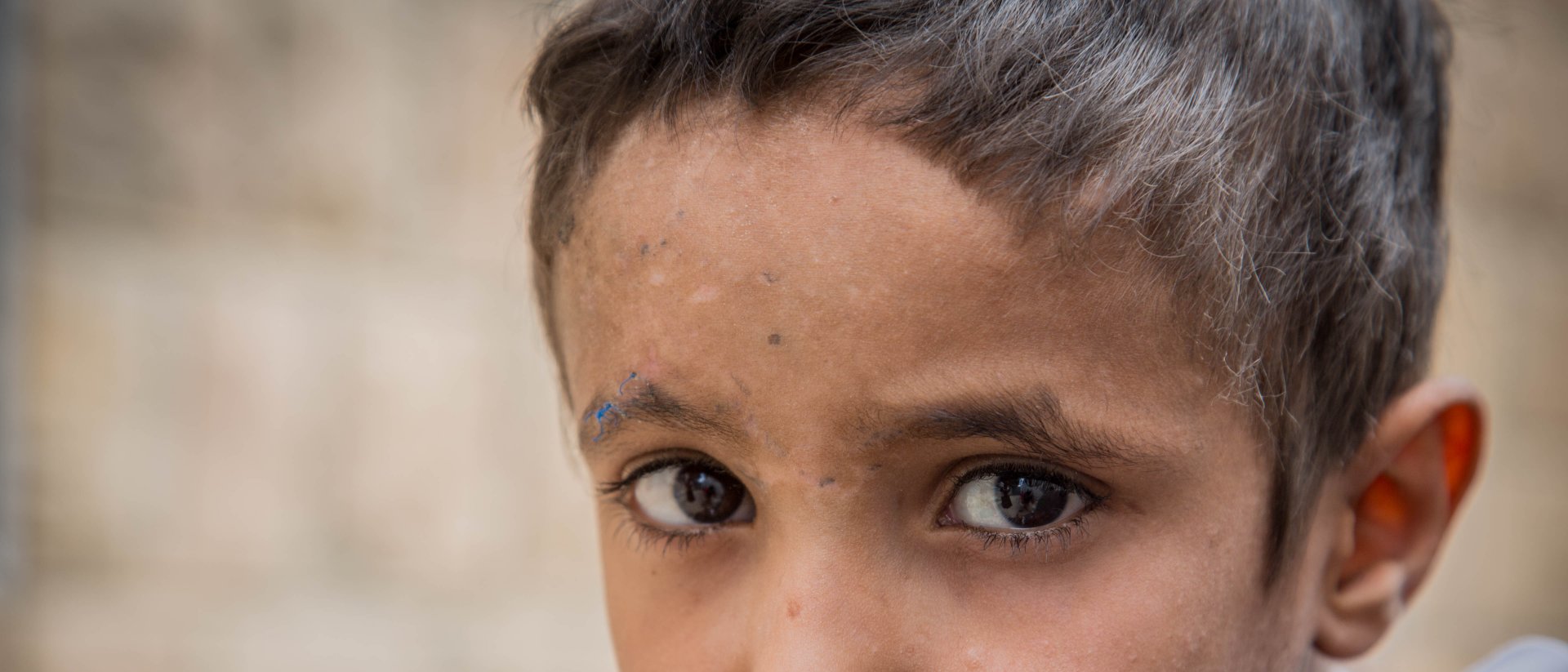niño que vive en zona de guerra niño que vive en zona de guerra