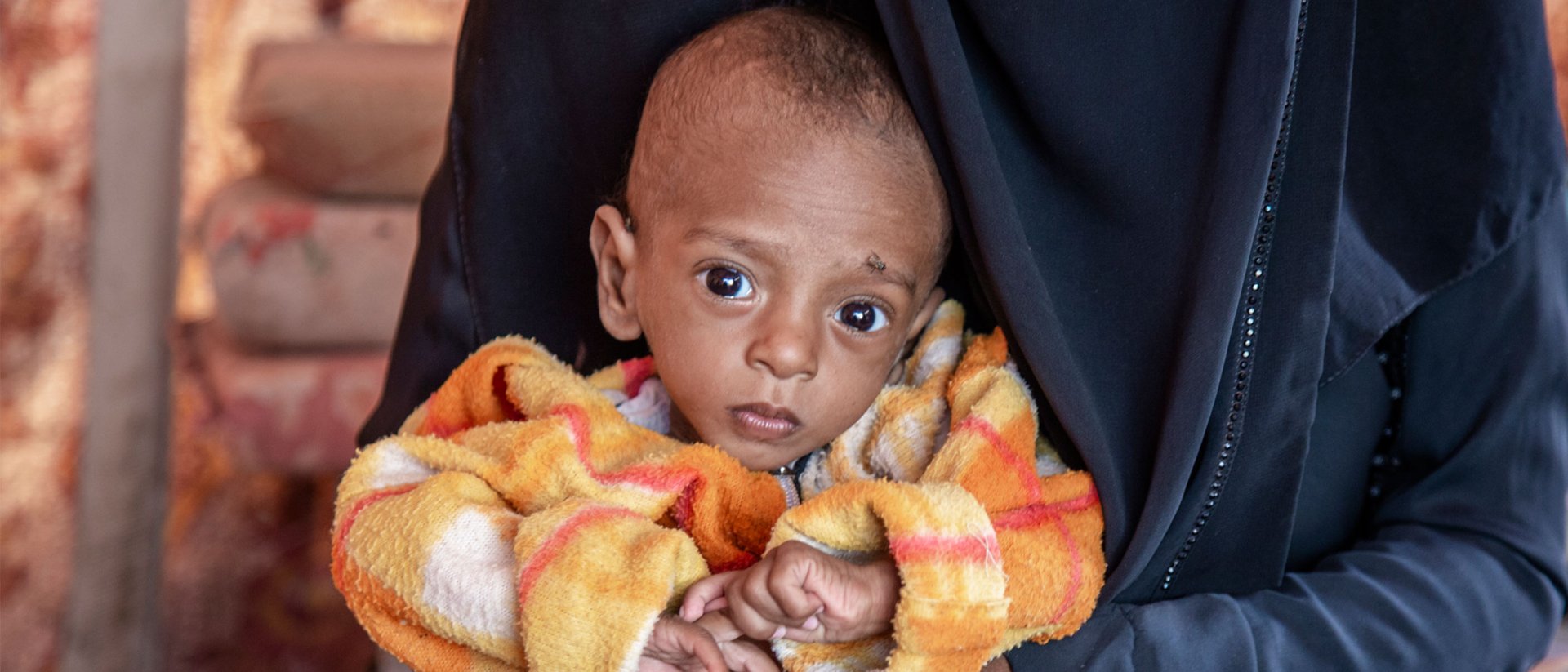 Nabil vino con 8 meses, sufría desnutrición aguda severa Nabil vino con 8 meses, sufría desnutrición aguda severa