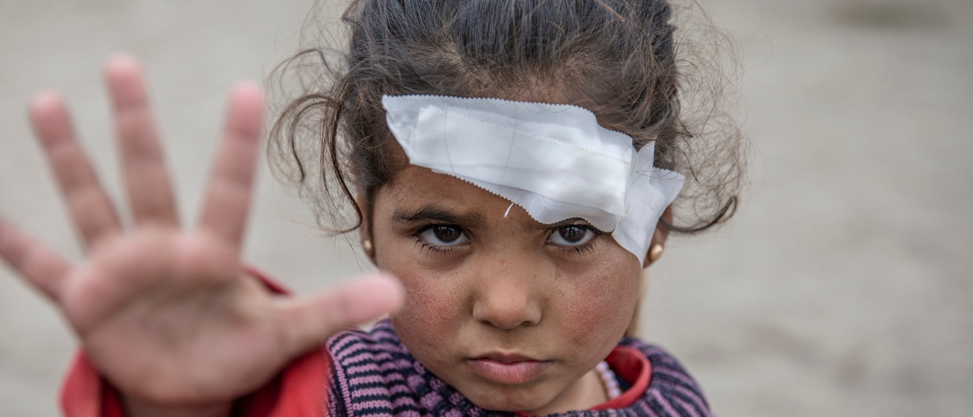 niños de guerra niña herida en la guerra