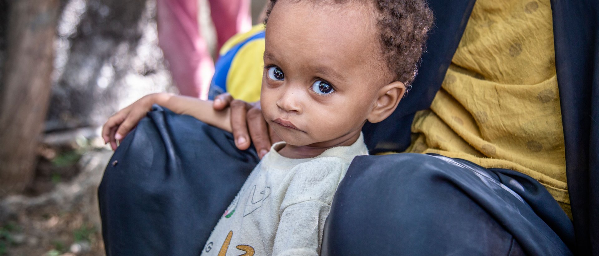 Noura tiene 15 meses y sufre de desnutrición severa Noura tiene 15 meses y sufre de desnutrición severa