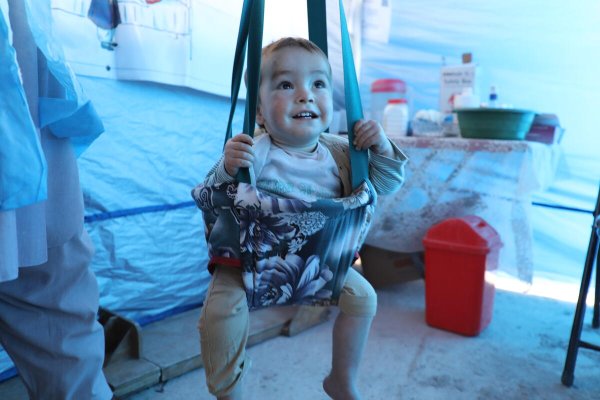 Mohammad, niño tratado de desnutrición_2
