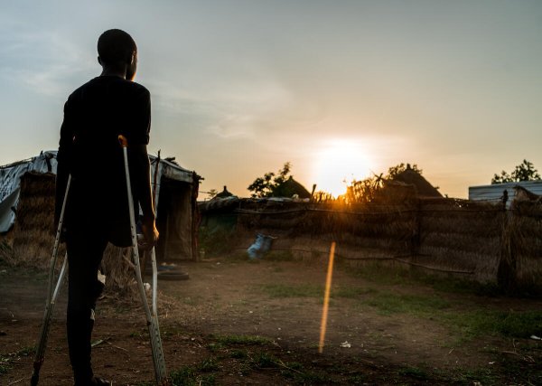 En Gedaref, Sudán, dos hermanos, Ali (13) y Nour (9), resultaron gravemente heridos cuando un proyectil explotó cerca de su casa mientras jugaban al fútbol: Ali perdió una pierna y Nour sufrió lesiones en la columna vertebral que le provocaron paraplejia. Foto: Hamid Abdulsalam/Save the Children