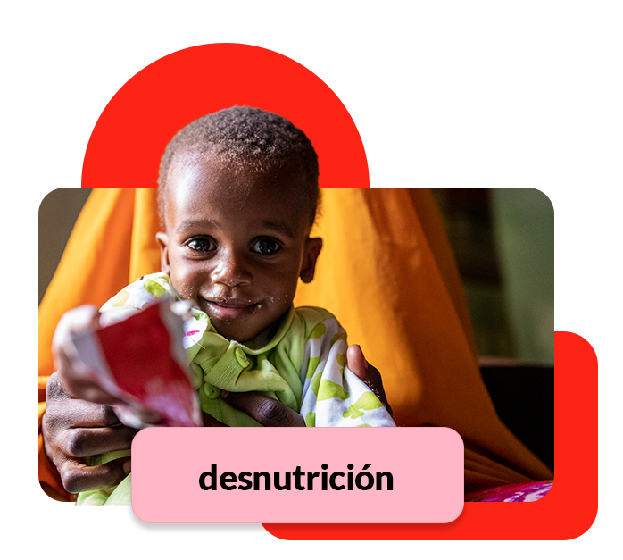 Ahmed comiendo gracias a nuestro programa de desnutrición