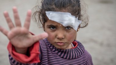 niña herida en la guerra