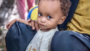 Noura tiene 15 meses y sufre de desnutrición severa