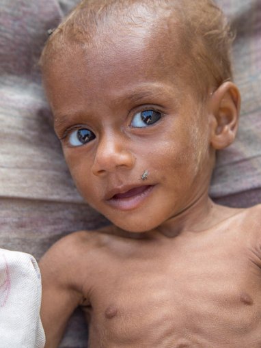 yemen-hambre.jpg yemen-hambre.jpg