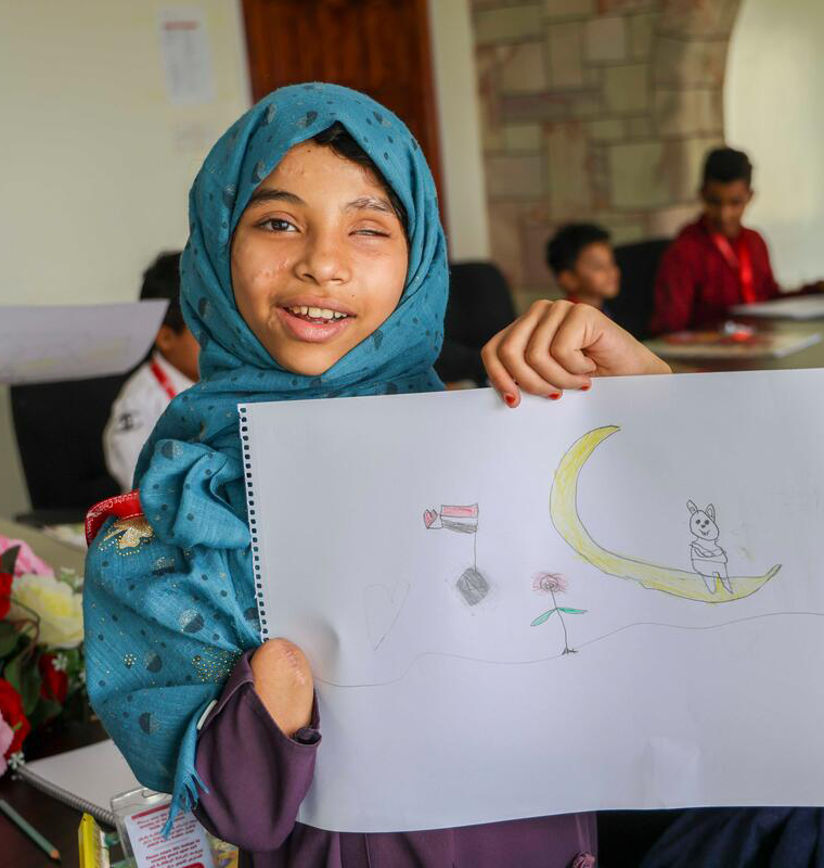 Maha, una niña yemení afectada por la explosión de una mina